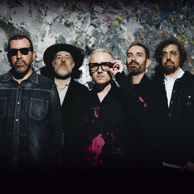 Hot Chip Bristol